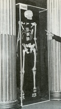 Alexis Le Trotteur's skeleton, Musée du Saguenay, 1977 © Société d'histoire de Charlevoix