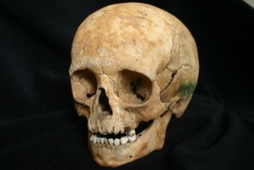 Crâne d'enfant provenant du cimetière St. Matthew à Québec